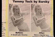 before-after