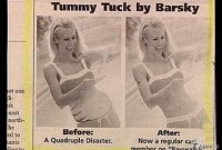 before-after