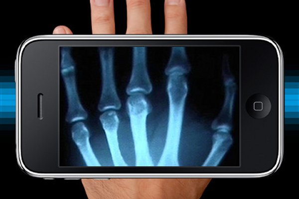 xray