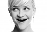 dents