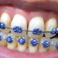 Top 10 des astuces pour éviter un gros bide en société